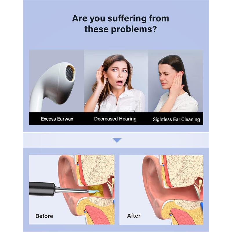 BEBIRD T5 3MP KAMERA 3.5MM LENS ŞARJLI WIFI GÖRÜNTÜLÜ KULAK TEMİZLEYİCİ SİYAH RENK - Image 2